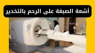 أشعة الصبغة على الرحم بالتخدير